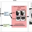 End-to-end lung cancer screening with three-dimensional deep learning on low-dose chest computed tomography - Nature Medicine