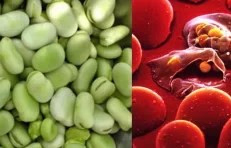 ما هي أنيميا الفول ؟