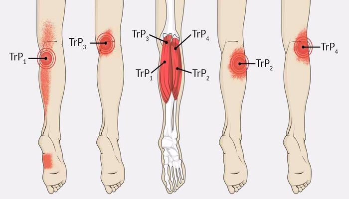 السباحة وفوائدها لمرضى بعض الاضطرابات النفسية والعصبية والعضلية